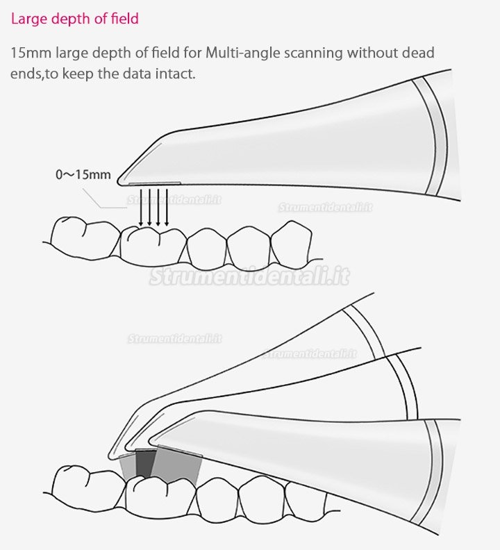 Fussen Scanner Intraorale Digitale 3D Dentale